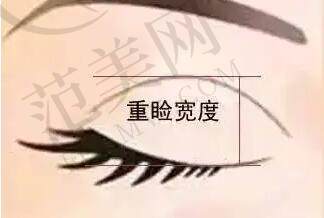 双眼皮动漫37.jpg?x-oss-process=style/fcamw
