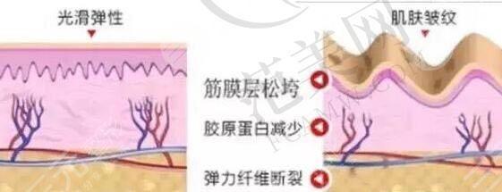热玛吉果怎么样