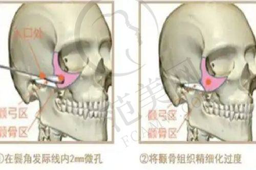 安康维美丽莎医疗美容医院怎么样，口碑评价如何？