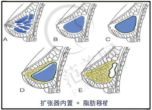 恩施天后整形医院地址及乘车路线
