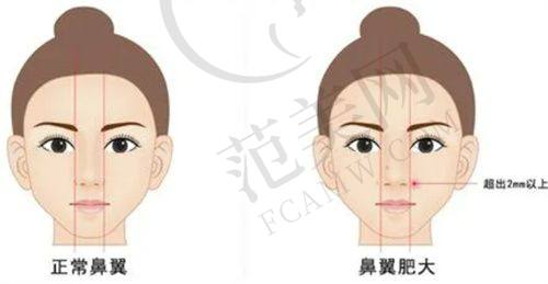 海口瑞韩医学美容医院口碑好不好？附真实患者口碑评价