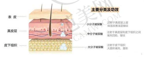 荔湾区人民医院美容科热门项目——隆鼻手术详解
