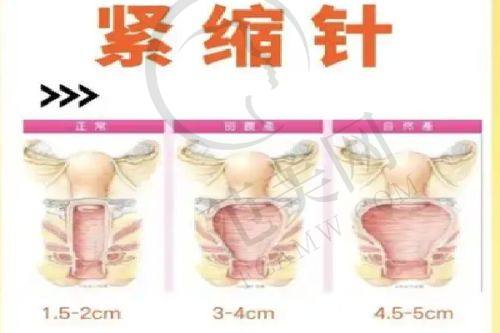 呼和浩特华美医学美容医院价格表