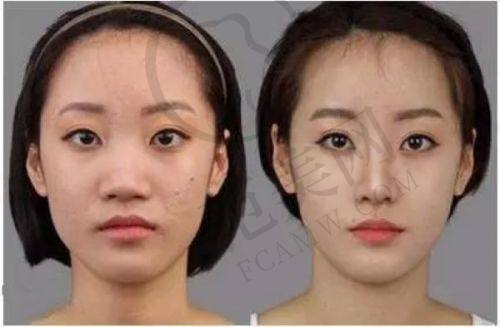 宁夏华美整形美容医院项目特色