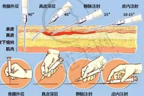 三、24小时真胸技术靠谱原因：WOLF内窥镜丰胸的超清优势