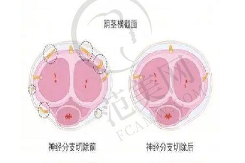 呼和浩特华美医学美容医院项目特色