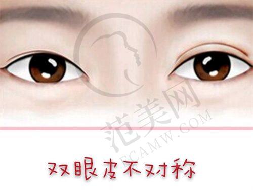 潮州华美整形美容医院口碑好不好？附真实患者口碑评价