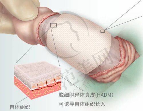 海南华美医学美容医院项目特色