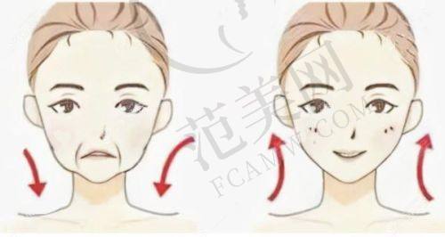 七、夏建军24小时真胸技术隆胸手术成效情况：非接触式假体植入的低感染风险