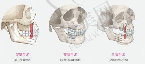 柳州华美整形医院地址及乘车路线
