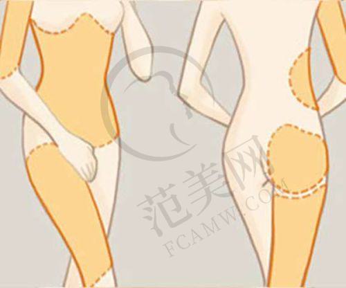 广州顾客对易普锋医生的好评实例