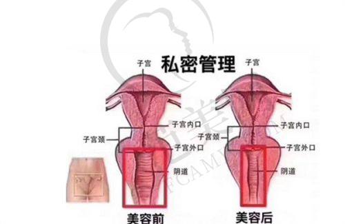 十一、夏建军隆胸费用情况：性价比极高的美丽选择