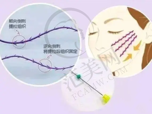 潮州华美整形美容医院项目特色