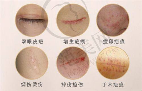 潮州华美整形美容医院怎么样，口碑评价如何？