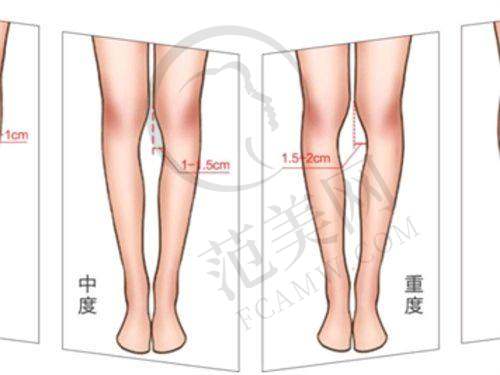 朱晓峰医生擅长的项目介绍