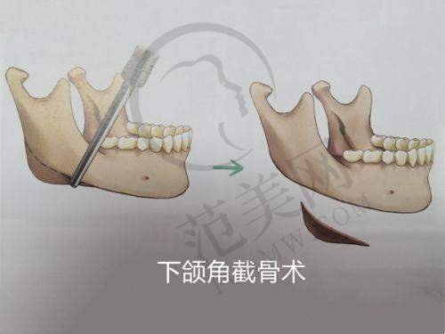 西宁美莱馨怡整形美容医院怎么样:医院简介大公开