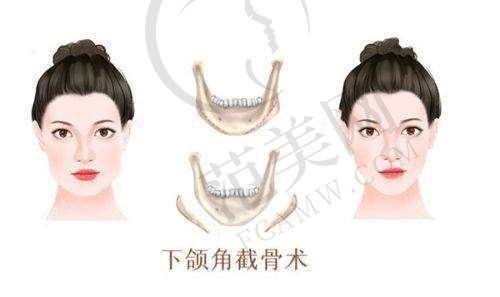 西宁美莱馨怡整形美容医院价格参考：性价比分析