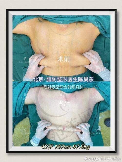 三、杭州彭涛所属医院情况之医院口碑怎样