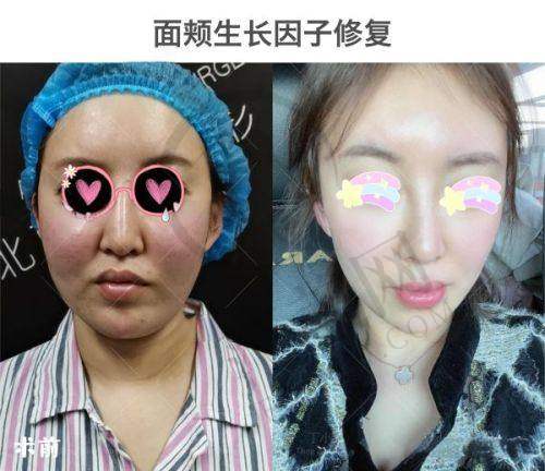 天津副乳吸脂排名前五：天津美泽医学美容专科门诊部