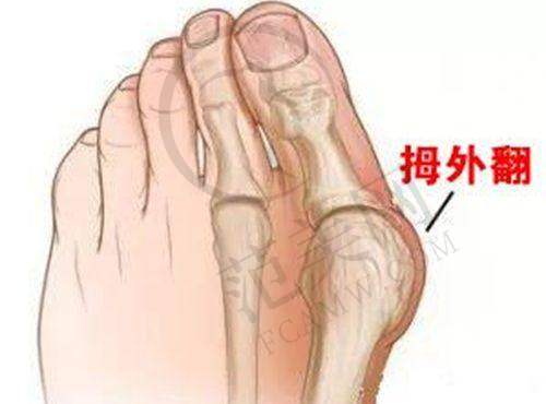 沈阳眼角下至排名总榜：沈阳名流美容医院