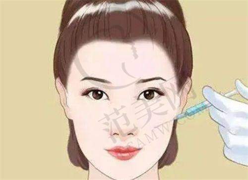 上海百达丽V - LINE瓜子脸手术128000元起是否划算