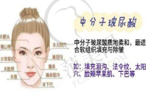 天津真美医院 - 简单修复快的自体脂肪丰太阳穴医院