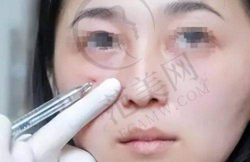 苏州眼综合十佳排名之苏州大学理想眼科医院