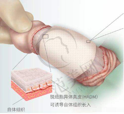 易成刚医生的服务理念