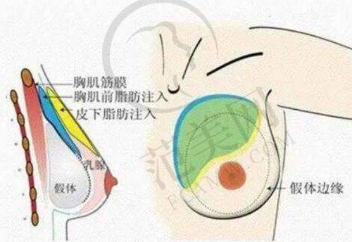 苏州眼综合十佳排名之苏州姑苏海维视眼科诊所