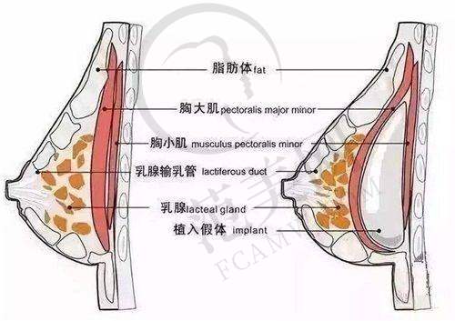 南京耳软骨复合隆鼻十佳排行：南京韩辰整形医院的实惠之选