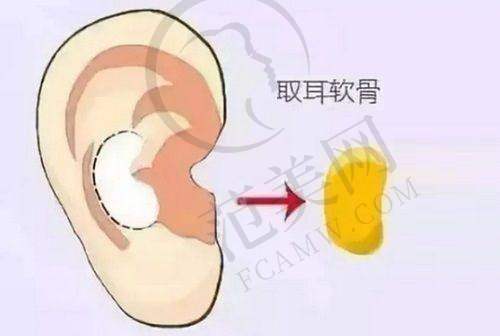 上海百达丽V - LINE瓜子脸手术128000元起优势深度解析