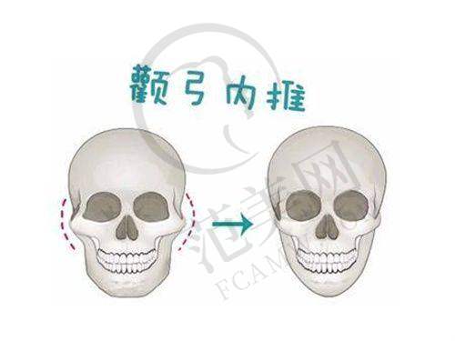 武汉二氧化碳点阵激光哪家便宜又好：总结与建议