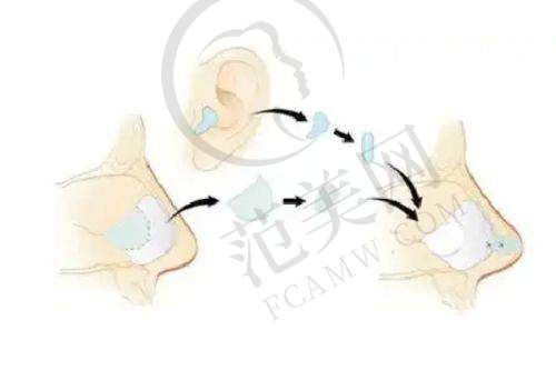天津非剥脱点阵激光哪家便宜又好：天津医 科 大学第二医院