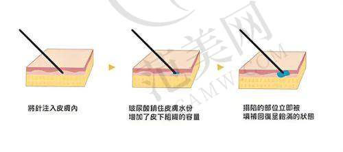 三、复旦大学附属华 山医院 - 皮肤科：皮肤病领域的佼佼者