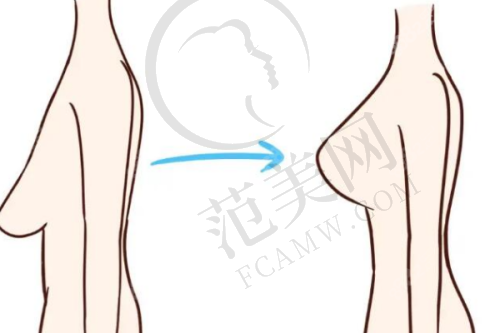 十二、上海江城疤痕修复中 心：专精治疗的可靠之地