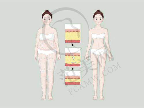 南京耳软骨复合隆鼻十佳排行：南京鼓楼医院的独特优势