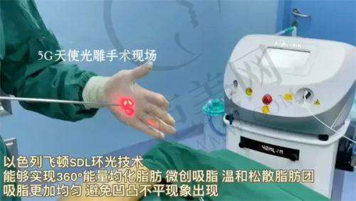 重庆星荣李世荣鼻骨内推18800元起，0.1mm精细截骨有效改善宽鼻驼峰不反复的技术原理
