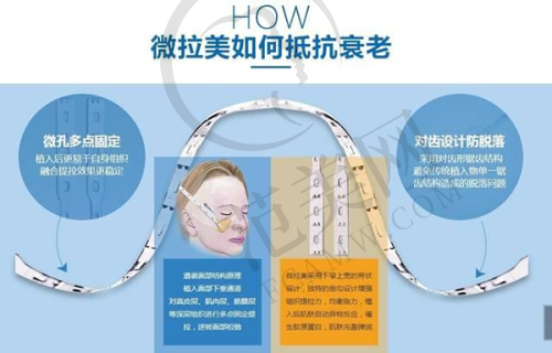 广州鼻骨内推十大行业佼佼者榜之南方医 科 大学南方医院整形美容外科