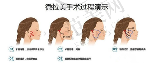南京维多利亚整形美容医院地址及乘车路线