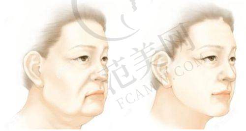 镇江苏王医疗美容门诊部价格表
