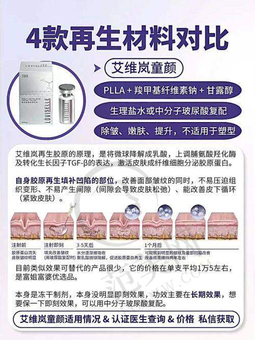 天津韩美整形美容医院 - 俏皮风格的自体脂肪丰太阳穴医院