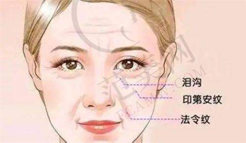 上海美莱肋骨鼻综合68000元起，仿生膨体鼻技术，多整形修复项目及医生推荐 