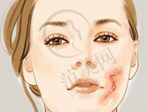 南京维多利亚整形美容医院口碑好不好？附真实患者口碑评价