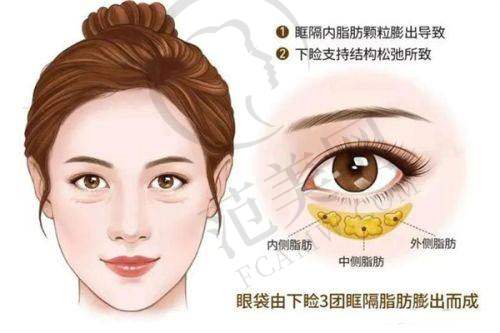 武汉二氧化碳点阵激光哪家便宜又好：项目价格对比