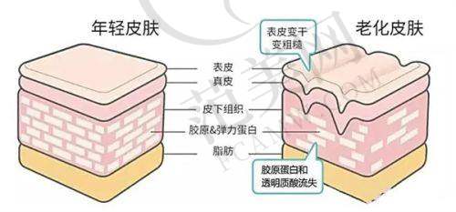 重庆星荣李世荣鼻骨内推18800元起，0.1mm精细截骨有效改善宽鼻驼峰不反复的术后注意事项