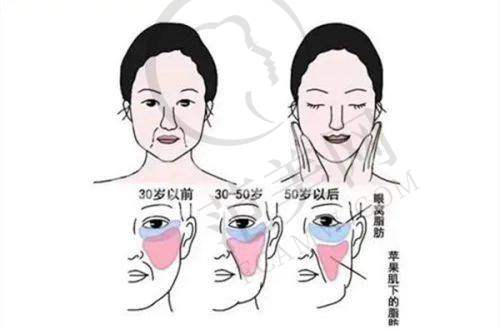 上海假体+自体脂肪丰胸哪家好：上海华美医疗美容医院