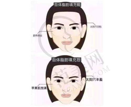武汉深蓝射频项目价格参考
