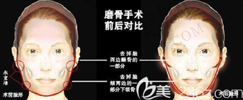 镇江苏王医疗美容门诊部怎么样，口碑评价如何？