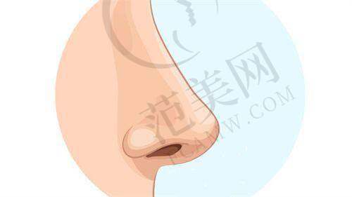 西安市泰瑞德眼角下至15000元起如何预约