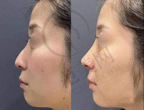 包头华美医疗美容医院口碑好不好？附真实患者口碑评价